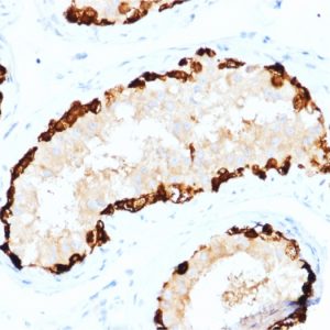Formalin-fixed, paraffin-embedded human Testis stained with MAGEA4 Mouse Monoclonal Antibody (CPTC-MAGEA4-1).