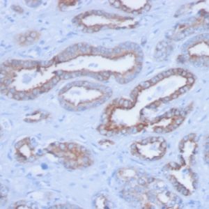 Formalin-fixed, paraffin-embedded human Prostate stained with Pan-Cytokeratin Mouse Monoclonal Antibody (PCK/3150).