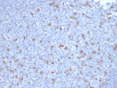 Formalin-fixed, paraffin-embedded human Tonsil stained with PD1 (CD279) Mouse Monoclonal Antibody (PDCD1/2720).