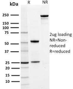 SDS-PAGE Analysis Purified PD-L1 Mouse Monoclonal Antibody (PDL1/2742). Confirmation of Purity and Integrity of Antibody.