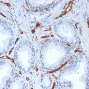 Formalin-fixed, paraffin-embedded human prostate stained with CD31 Mouse Monoclonal Antibody (PECAM1/3527).