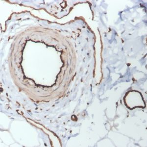 Formalin-fixed, paraffin-embedded human skin stained with CD31 Mouse Monoclonal Antibody (PECAM1/3530).