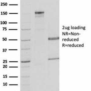 SDS-PAGE Analysis Purified MDH1 Mouse Monoclonal Antibody (CPTC-MDH1-1). Confirmation of Purity and Integrity of Antibody.