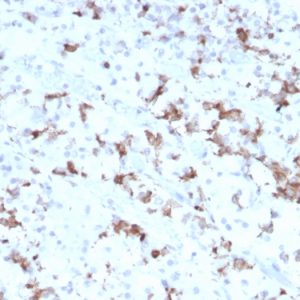 Formalin-fixed, paraffin-embedded human Pituitary stained with Prolactin Mouse Monoclonal Antibody (PRL/2641).
