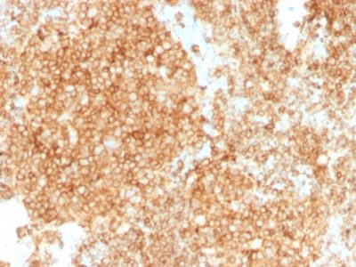 Formalin-fixed, paraffin-embedded human Tonsil stained with CD45 Mouse Monoclonal Antibody (PTPRC/1147 + PTPRC/1460).