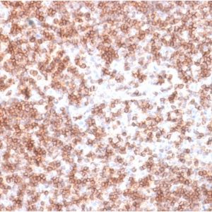 Formalin-fixed, paraffin-embedded human Lymph Node stained with CD45 RabbitRecombinant Monoclonal Antibody (PTPRC/1975R).