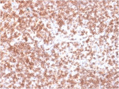 Formalin-fixed, paraffin-embedded human Lymph Node stained with CD45 RabbitRecombinant Monoclonal Antibody (PTPRC/1975R).