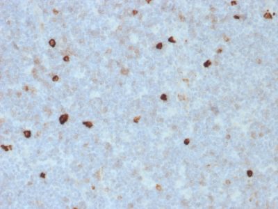Formalin-fixed, paraffin-embedded human Tonsil stained with IgM Mouse Monoclonal Antibody (R1/69).