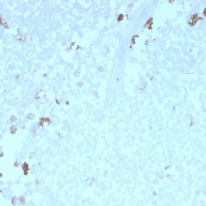 Formalin-fixed, paraffin-embedded human Uterus stained with ATG5 Mouse Monoclonal Antibody (rATG5/2553).
