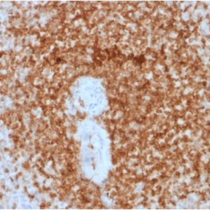 Formalin-fixed, paraffin-embedded human Spleen stained with Bcl-2 Mouse Recombinant Monoclonal Antibody (rBCL2/796).