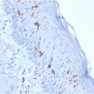 Formalin-fixed, paraffin-embedded human Skin stained with CD1a Mouse Recombinant Monoclonal Antibody (rC1A/711).