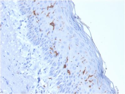 Formalin-fixed, paraffin-embedded human Skin stained with CD1a Mouse Recombinant Monoclonal Antibody (rC1A/711).