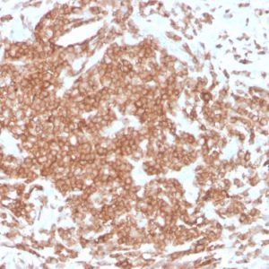 Formalin-fixed, paraffin-embedded human tonsil stained with CD3e Recombinant Mouse Monoclonal Antibody (rC3e/1308).