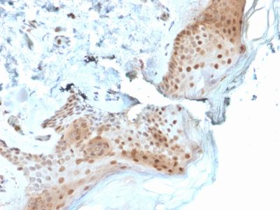 Formalin-fixed, paraffin-embedded human Skin stained with 8-oxoguanine Mouse Monoclonal Antibody (CPTC-OGG1-1).