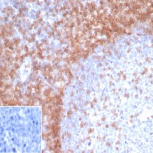 Formalin-fixed, paraffin-embedded human Spleen stained with CD3eRecombinant Mouse Monoclonal Antibody (rC3e/1931).