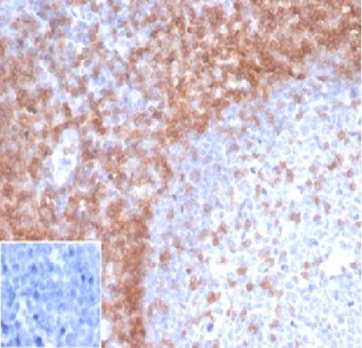 Formalin-fixed, paraffin-embedded human Spleen stained with CD3eRecombinant Mouse Monoclonal Antibody (rC3e/1931).