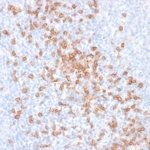 Formalin-fixed, paraffin-embedded human Tonsil stained with CD8 Mouse Recombinant Monoclonal Antibody (rC8/468).