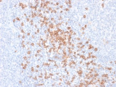 Formalin-fixed, paraffin-embedded human Tonsil stained with CD8 Mouse Recombinant Monoclonal Antibody (rC8/468).