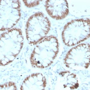 Formalin-fixed, paraffin-embedded human Colon stained with CDX2 Mouse Monoclonal Antibody (rCDX2/1690).