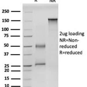 SDS-PAGE Analysis Purified RET-Monospecific Mouse Monoclonal Antibody (RET/2599). Confirmation of Integrity and Purity of Antibody
