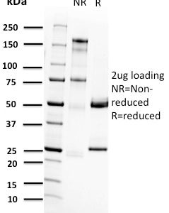 SDS-PAGE Analysis Purified RET Mouse Monoclonal Antibody (RET/2662). Confirmation of Purity and Integrity of Antibody.