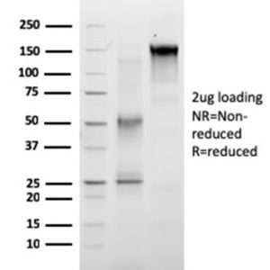 SDS-PAGE Analysis of Purified RET Mouse Monoclonal Antibody (RET/2663). Confirmation of Purity and Integrity of Antibody.