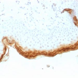 Formalin-fixed, paraffin-embedded human Skin stained with Filaggrin Mouse Recombinant Monoclonal Antibody (rFLG/1561).