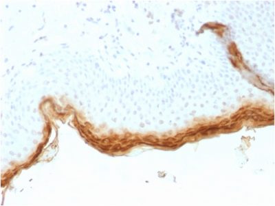Formalin-fixed, paraffin-embedded human Skin stained with Filaggrin Mouse Recombinant Monoclonal Antibody (rFLG/1561).