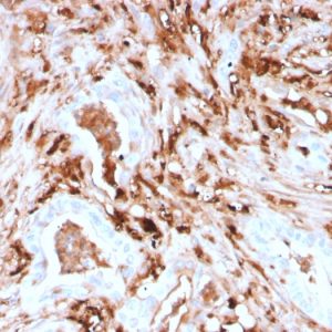 Formalin-fixed, paraffin-embedded human Pancreas stained with Ferritin, Light Chain Recombinant Mouse Monoclonal Antibody (rFTL/1388).