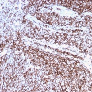 Formalin-fixed, paraffin-embedded human Cervix stained with CD44 Recombinant Mouse Monoclonal Antibody (rHCAM/918).