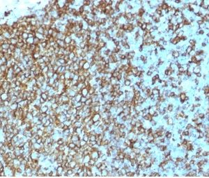 Formalin-fixed, paraffin-embedded human Tonsil stained with HLA-Pan Mouse Recombinant Monoclonal Antibody (rHLA-Pan/3475).