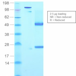 SDS-PAGE Analysis Purified IgM Mouse Recombinant Monoclonal Antibody (rIGHM/2558). Confirmation of Purity and Integrity of Antibody.