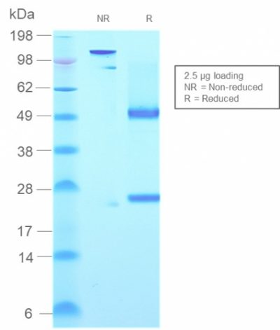 SDS-PAGE Analysis Purified IgM Mouse Recombinant Monoclonal Antibody (rIGHM/2558). Confirmation of Purity and Integrity of Antibody.