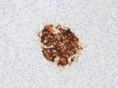 Formalin-fixed, paraffin-embedded human Pancreas stained with Insulin Mouse Recombinant Monoclonal Antibody (rIRDN/805).