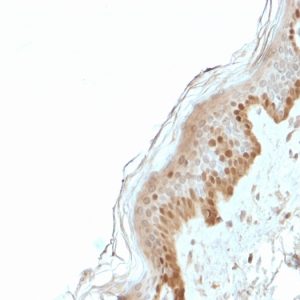 Formalin-fixed, paraffin-embedded human Skin stained with S100A2 Mouse Monoclonal Antibody (CPTC-S100A2-2).