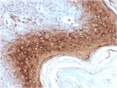 Formalin-fixed, paraffin-embedded human Skin stained with Involucrin Mouse Recombinant Monoclonal Antibody (rIVRN/827).