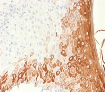 Formalin-fixed, paraffin-embedded human skin stained with Cytokeratin 10 Mouse Recombinant Monoclonal Antibody (rKRT10/1275).