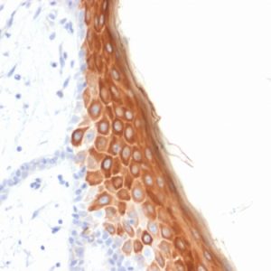 Formalin-fixed, paraffin-embedded human Skin stained with Cytokeratin 10 Mouse Recombinant Monoclonal Antibody (rKRT10/844).