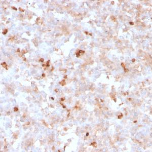 Formalin-fixed, paraffin-embedded human tonsil stained with Lambda Light Chain Recombinant Mouse Monoclonal Antibody (rLLC/1738).