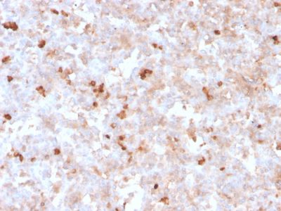 Formalin-fixed, paraffin-embedded human tonsil stained with Lambda Light Chain Recombinant Mouse Monoclonal Antibody (rLLC/1738).