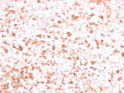 Formalin-fixed, paraffin-embedded human Tonsil stained with Lambda Light Chain Recombinant Mouse Monoclonal Antibody (rLLC/3777).