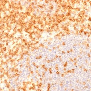 Formalin-fixed, paraffin-embedded human Tonsil stained with CD27 Recombinant Mouse Monoclonal Antibody (rLPFS2/1611).