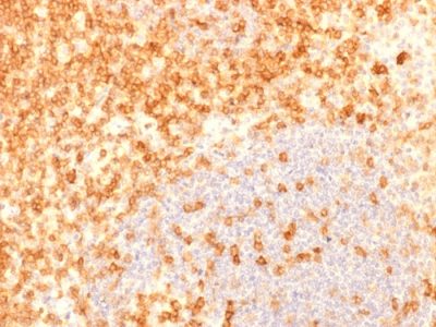 Formalin-fixed, paraffin-embedded human Tonsil stained with CD27 Recombinant Mouse Monoclonal Antibody (rLPFS2/1611).