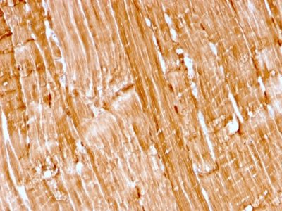 Formalin-fixed, paraffin-embedded human skeletal muscle stained with Myoglobin Recombinant Mouse Monoclonal Antibody (rMB/2105).