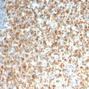 Formalin-fixed, paraffin-embedded human Tonsil stained with MCM7 Recombinant Mouse Monoclonal Antibody (rMCM7/1468).
