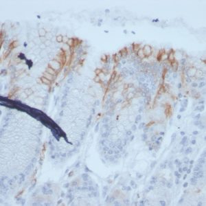 SDS-PAGE Analysis Purified MUC2 Recombinant Mouse Monoclonal Antibody (rMLP/842). Confirmation of Purity and Integrity of Antibody.