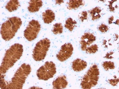 Formalin-fixed, paraffin-embedded human colon stained with MUC5AC Recombinant Mouse Monoclonal Antibody (rMUC5AC/3779).