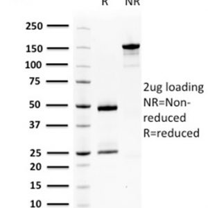 SDS-PAGE Analysis Purified SqCC Antigen 1 Mouse Monoclonal Antibody (CPTC-SERPINB3-2). Confirmation of Purity and Integrity of Antibody