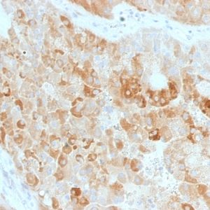 Formalin-fixed, paraffin-embedded human Kidney stained with ROR2 Mouse Monoclonal Antibody (ROR2/1911).