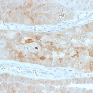 Formalin-fixed, paraffin-embedded human Kidney stained with ROR2 Mouse Monoclonal Antibody (ROR2/1912).